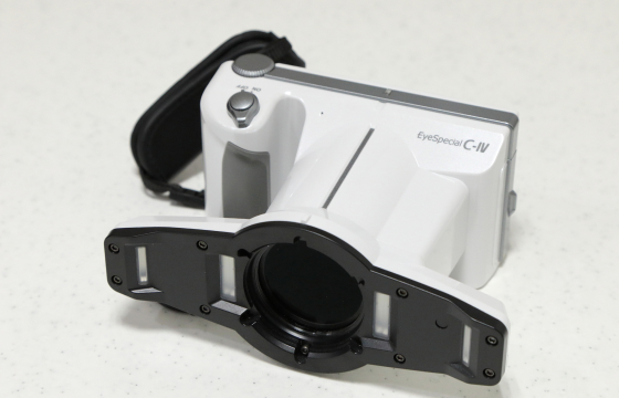 歯の型取りと色の選択